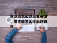 黑芝麻怎么吃治白头发，黑芝麻怎么吃治疗斑秃