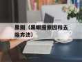黑圈（黑眼圈原因和去除方法）