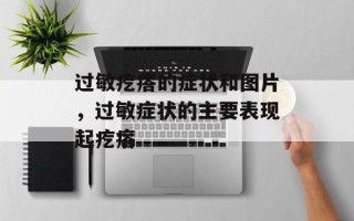 过敏疙瘩的症状和图片，过敏症状的主要表现起疙瘩
