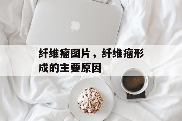 纤维瘤图片，纤维瘤形成的主要原因-第1张图片-