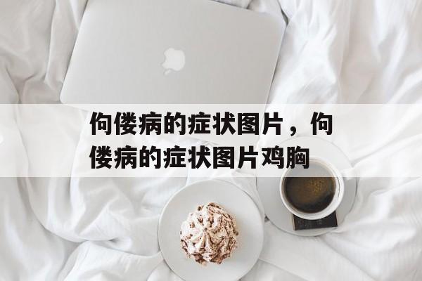 佝偻病的症状图片，佝偻病的症状图片鸡胸-第1张图片-